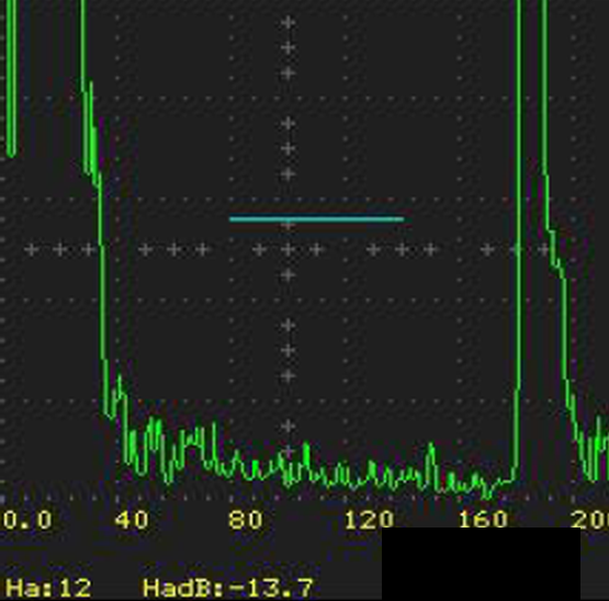 Repeat ultrasonic inspection of the 180 mm 2Cr10NiMoVNb bar after 1000 C x 3 h normalizing: no spurious echoes, meeting GB/T 4162 Grade A